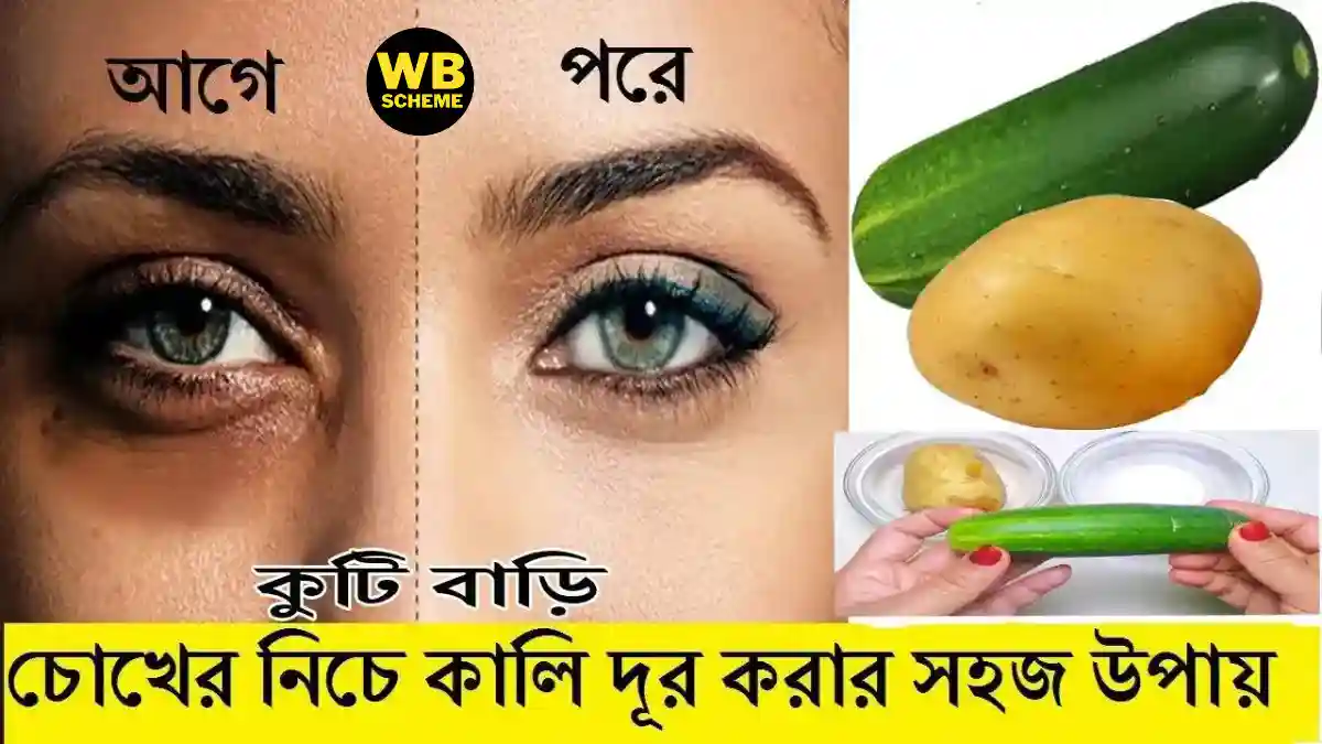 কিভাবে চোখের নিচের কালো দাগ দূর করবেন, যেকোনো কালো দাগ দূর করার পদ্ধতি